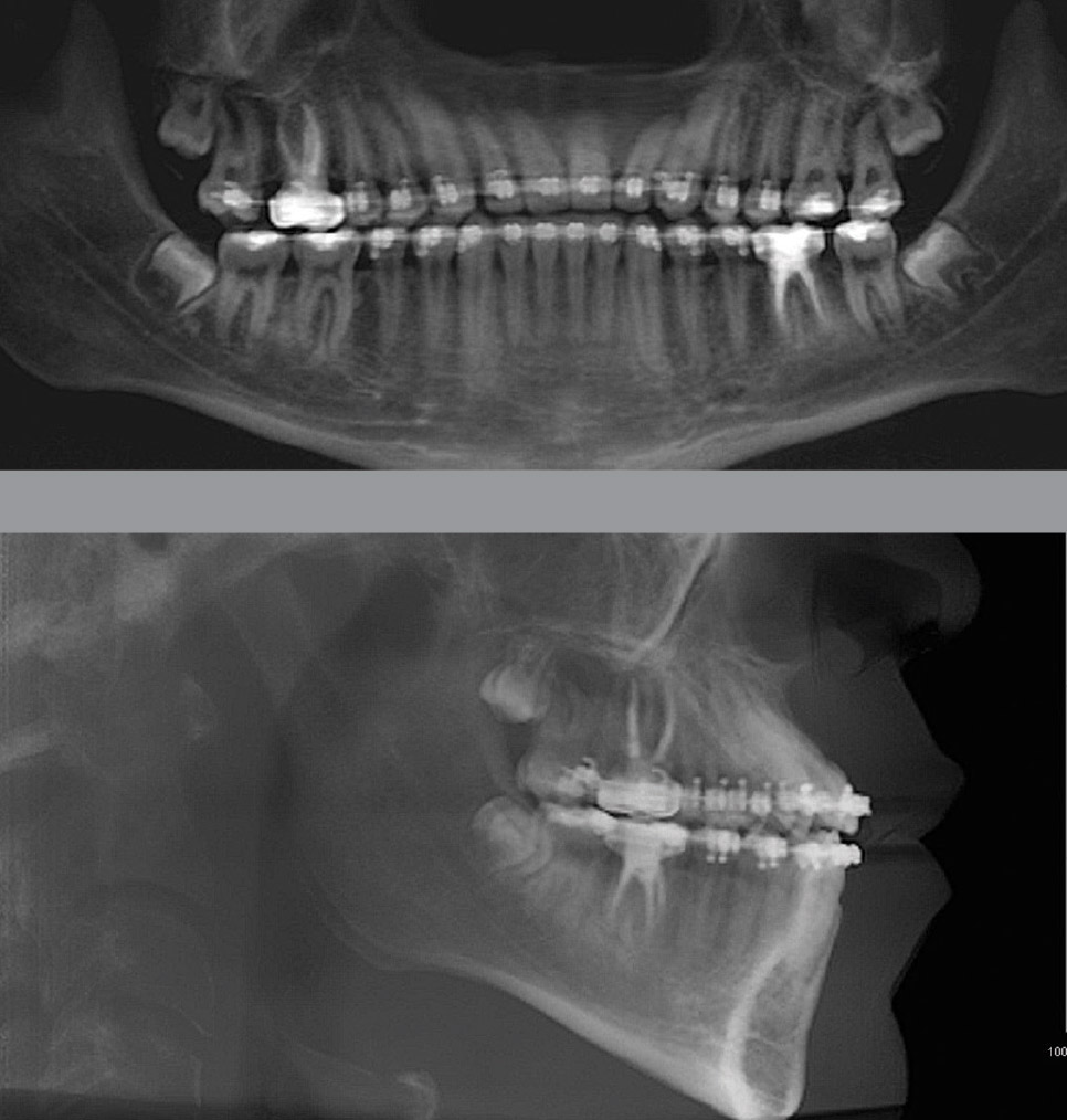 before and after pictures of male patient cont.