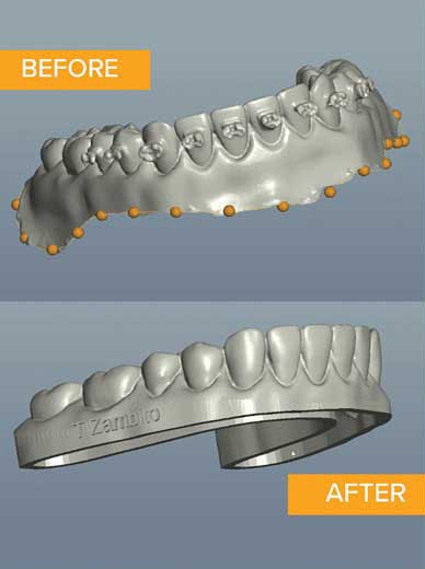 EasyRX 3D ABR