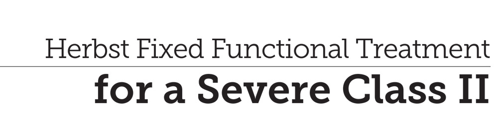 Header: Herbst Fixed Functional Treatment for a Severe Class II
