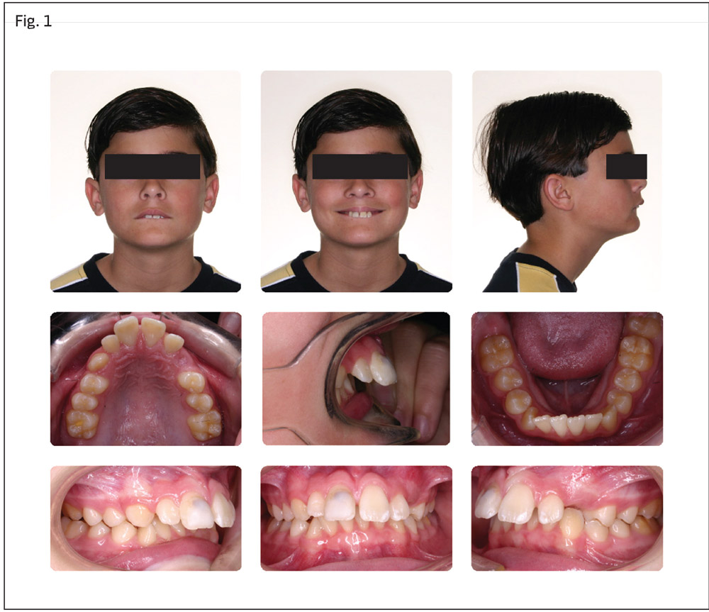 Fig. 1