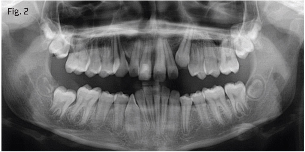 Fig. 2