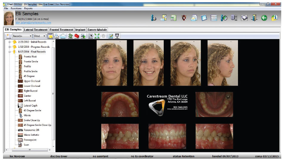 Carestream Dental's CS OrthoTrac Cloud