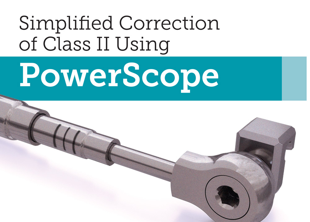 Header: Simplified Correction of Class II Using Powerscope