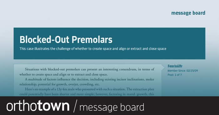 Blocked-Out Premolars