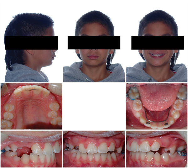 The Breathing Blueprint