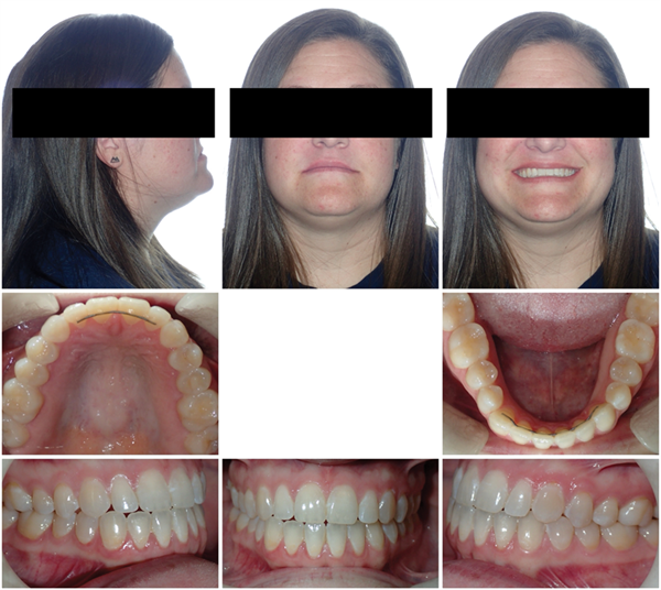 The Breathing Blueprint