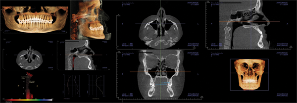 The Breathing Blueprint