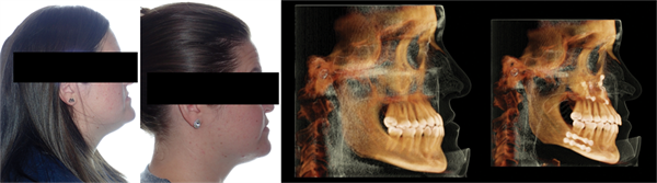 The Breathing Blueprint