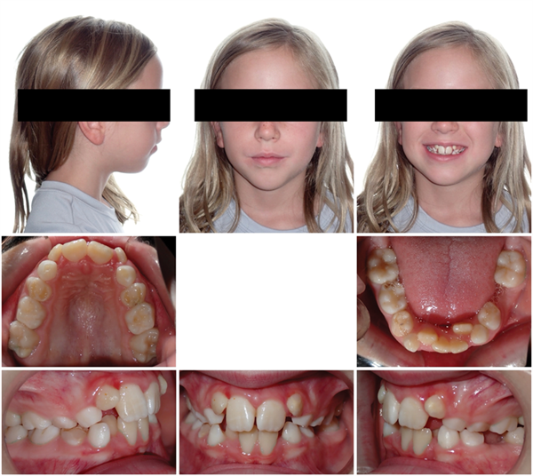 The Breathing Blueprint