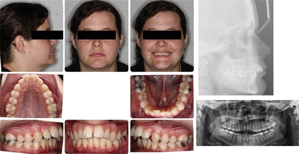 The Architects of the Lips: Part 3