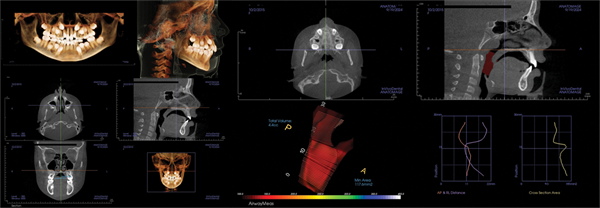 The Breathing Blueprint