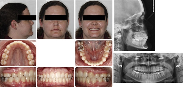 The Architects of the Lips: Part 3