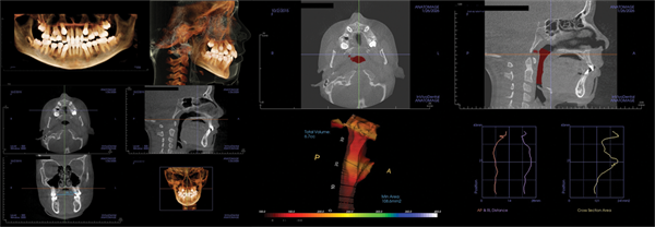 The Breathing Blueprint
