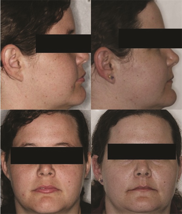 The Architects of the Lips: Part 3