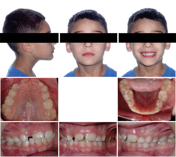 The Breathing Blueprint