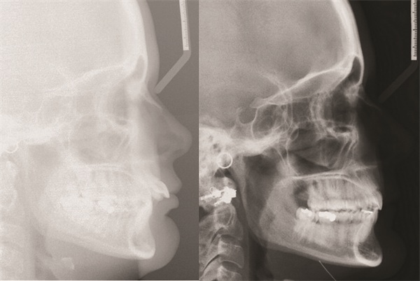 The Architects of the Lips: Part 3