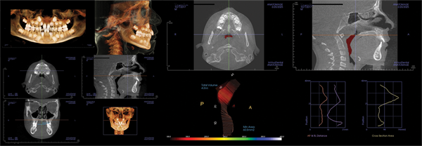 The Breathing Blueprint