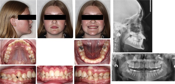 The Architects of the Lips: Part 3