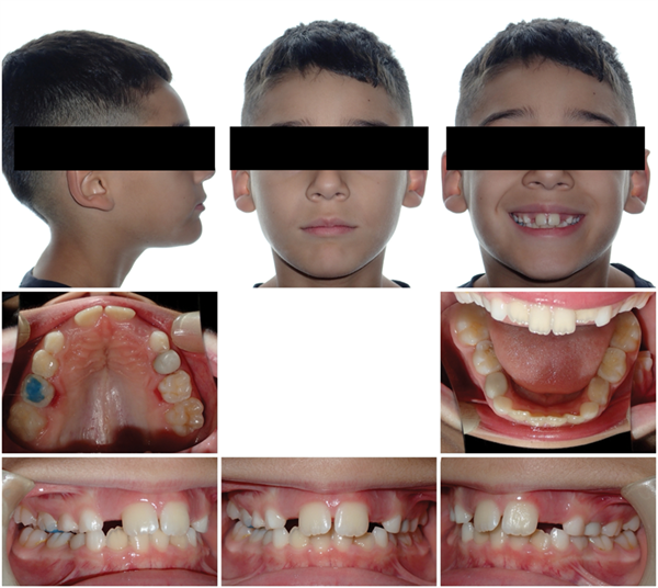 The Breathing Blueprint