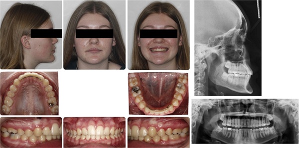 The Architects of the Lips: Part 3