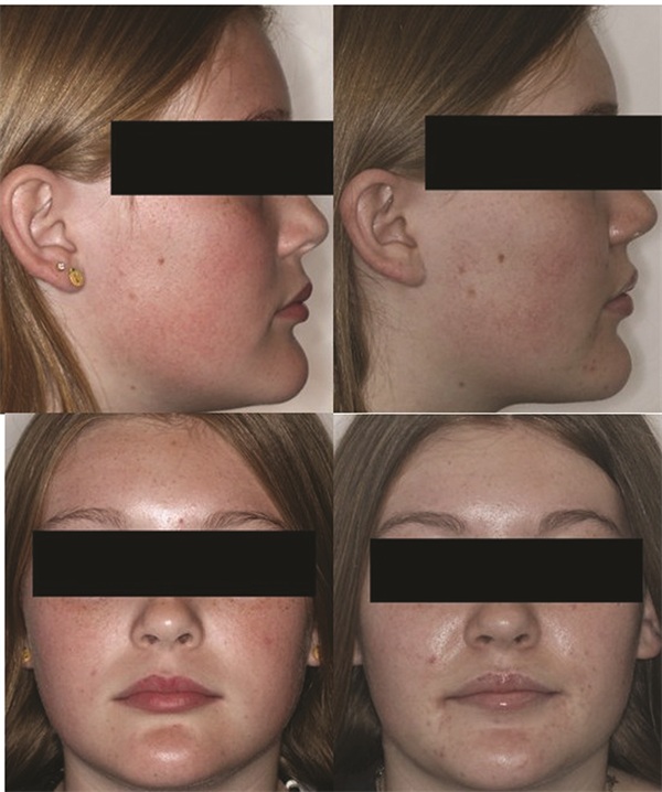 The Architects of the Lips: Part 3