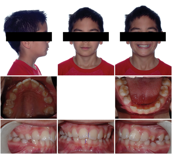 The Breathing Blueprint