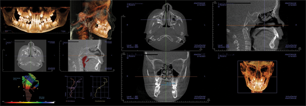 The Breathing Blueprint