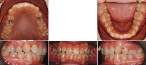 From Underwater to Unstoppable