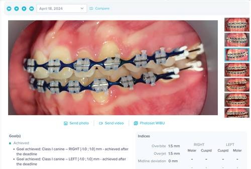 From Underwater to Unstoppable