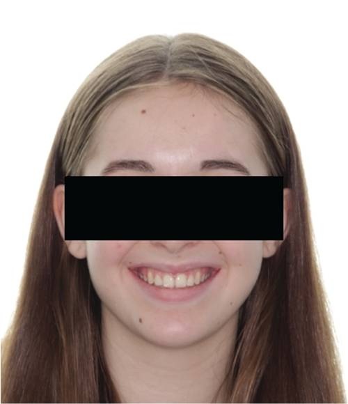 From Underwater to Unstoppable