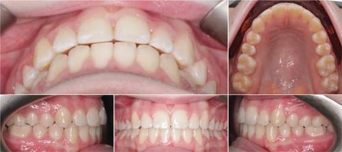 From Underwater to Unstoppable