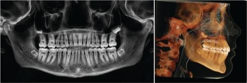 From Underwater to Unstoppable