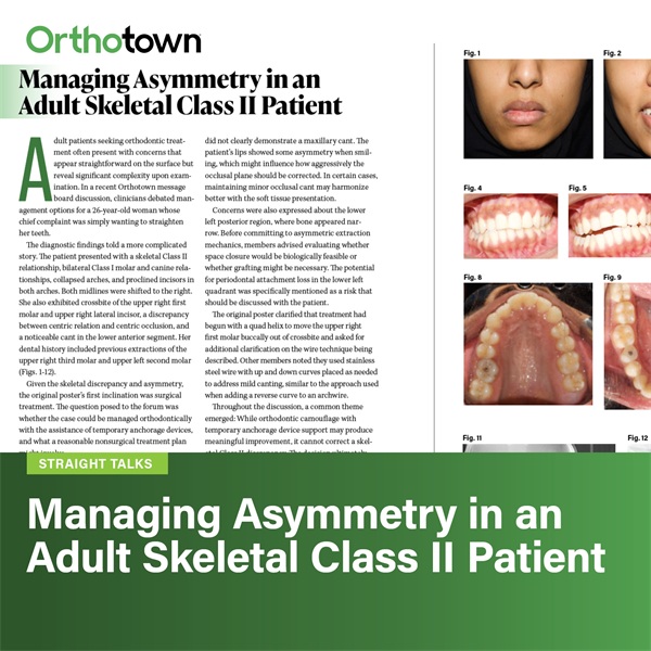 Managing Asymmetry in an Adult Skeletal Class II Patient