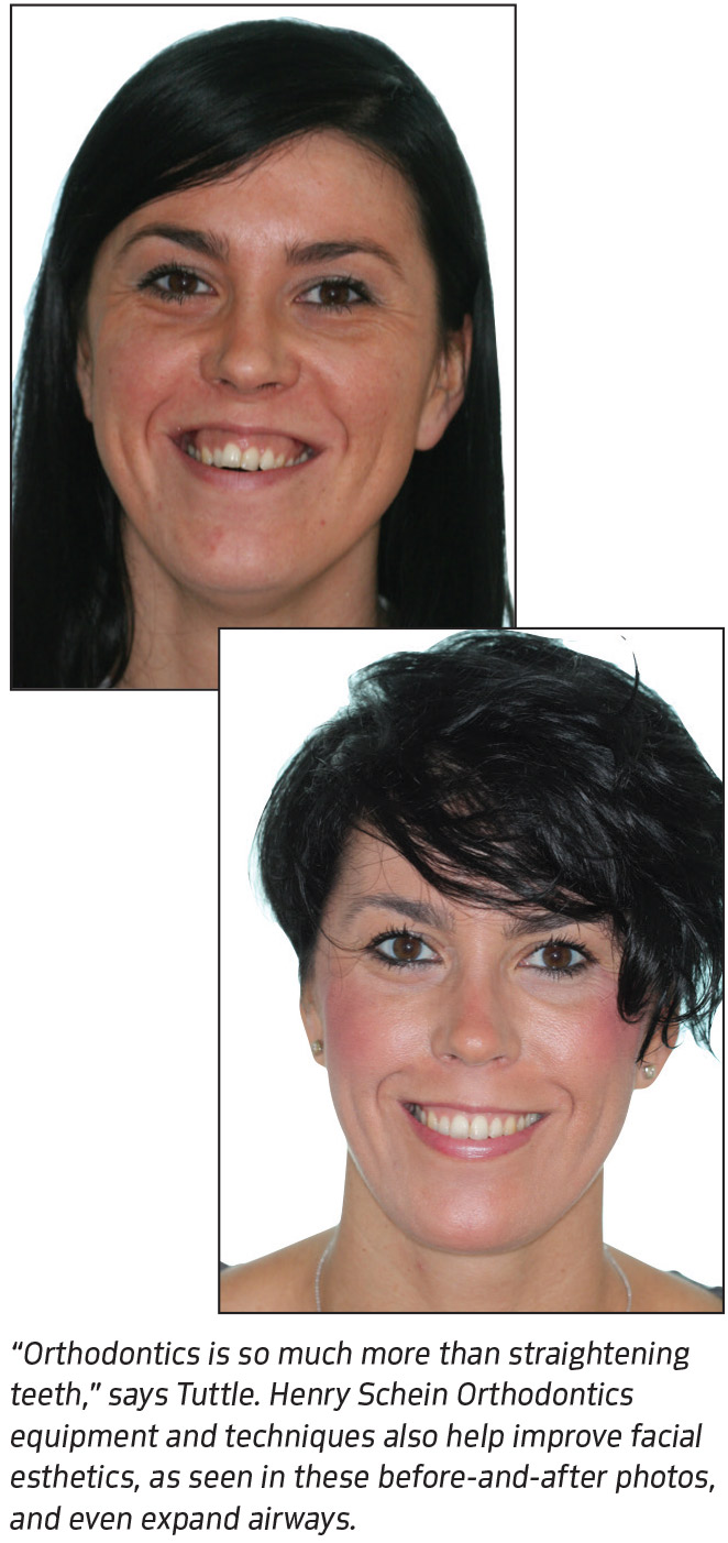 Patient before/after pictures