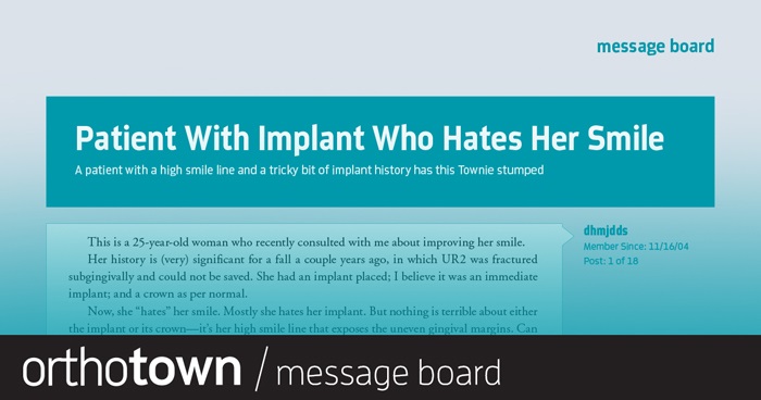 Patient With Implant Who Hates Her Smile