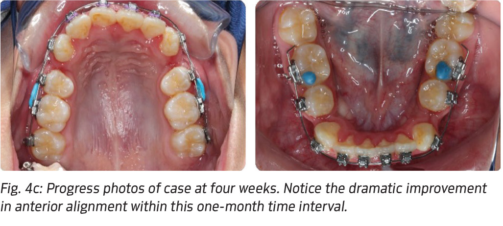 Fig. 4c