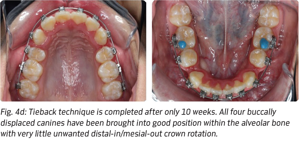 Fig. 4d