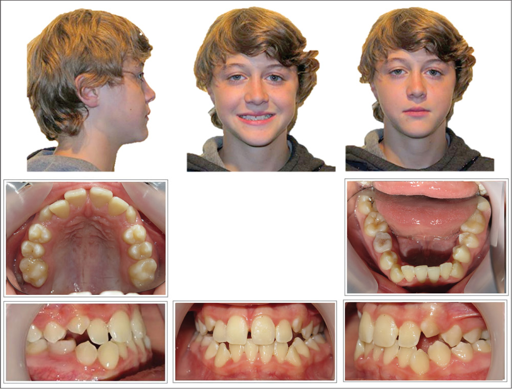 Patient photos