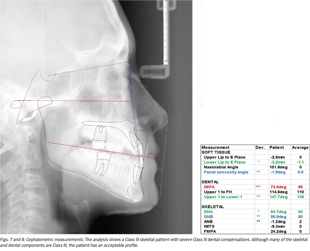 Fig. 7 and 8