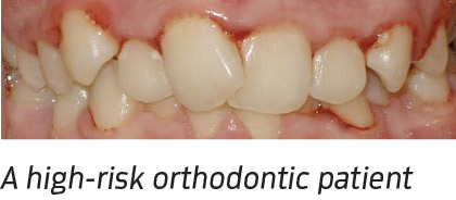 A high-risk orthodontic patient