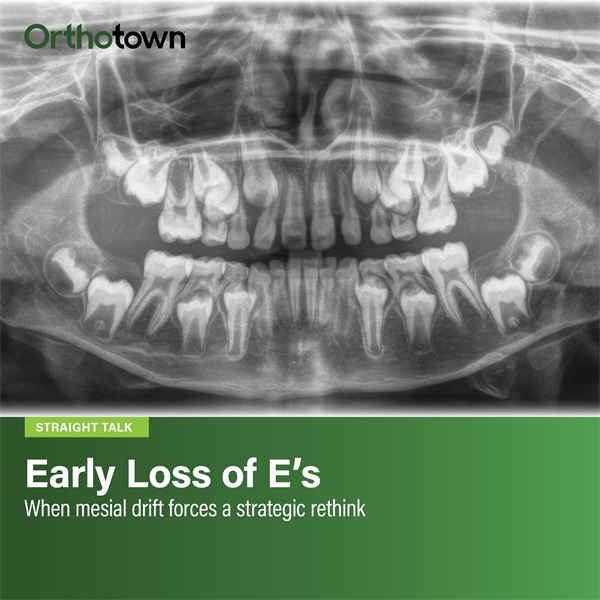 Early Loss of E's