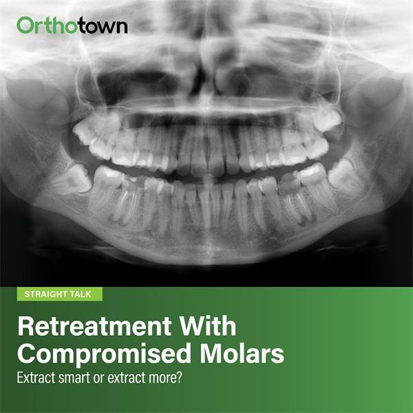 Retreatment With Compromised Molars
