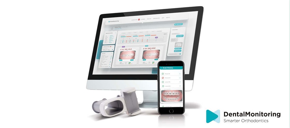 Product Profile: DentalMonitoring