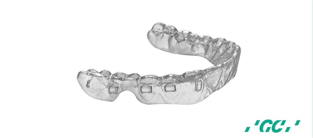 Product Profile: MOV’Aligners