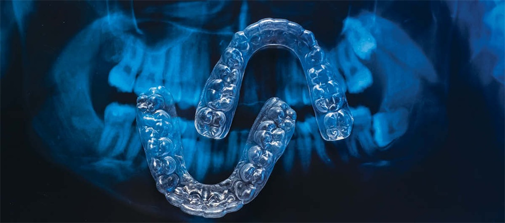 5 Proven Strategies to Improve Clear Aligner Outcomes