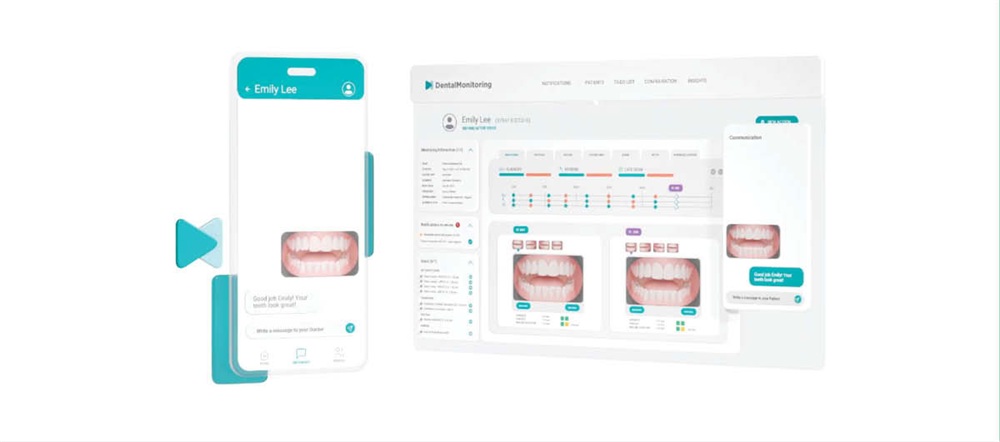 Game Changers: The First Step in Adopting Remote Monitoring