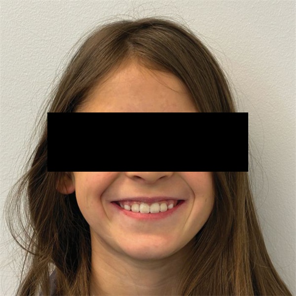 A Modern Approach to Phase 1 Orthodontic Treatment