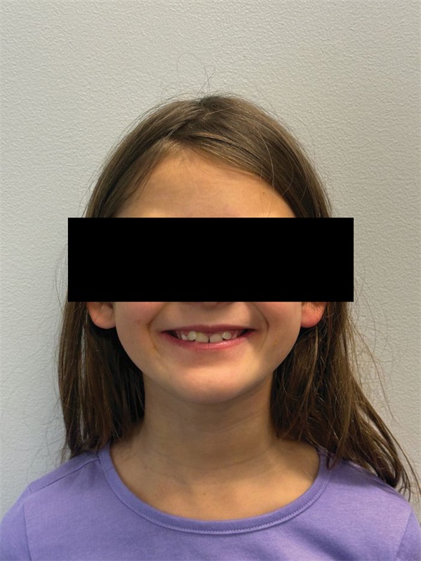 A Modern Approach to Phase 1 Orthodontic Treatment
