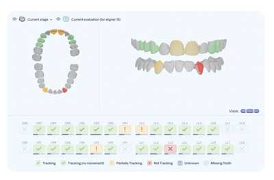 Grin 3D Tx Tracker