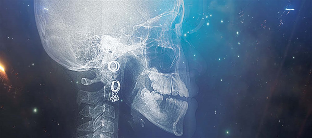 Iatrogenic Challenges